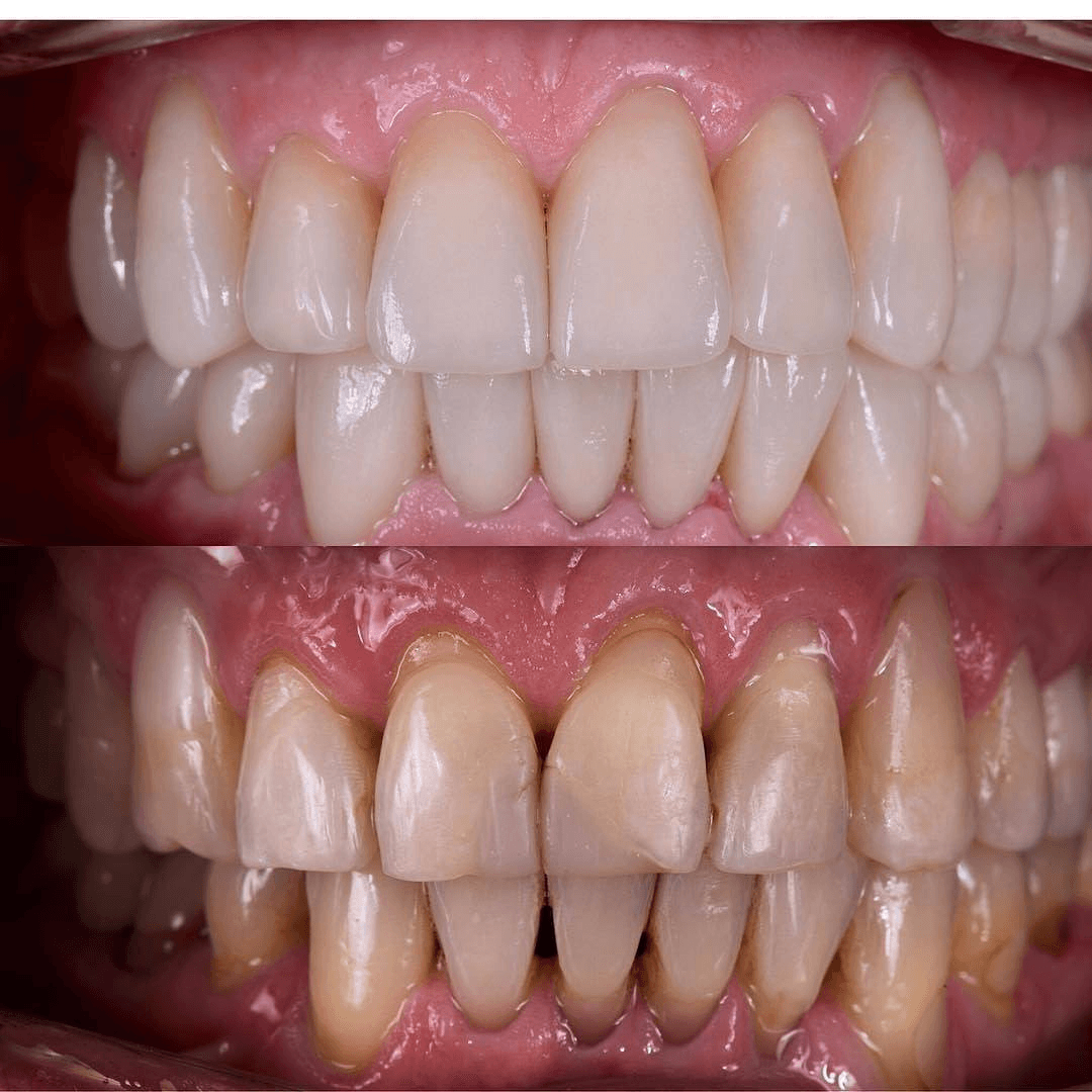 תוצאה קלינית 7 - Doctor Ox