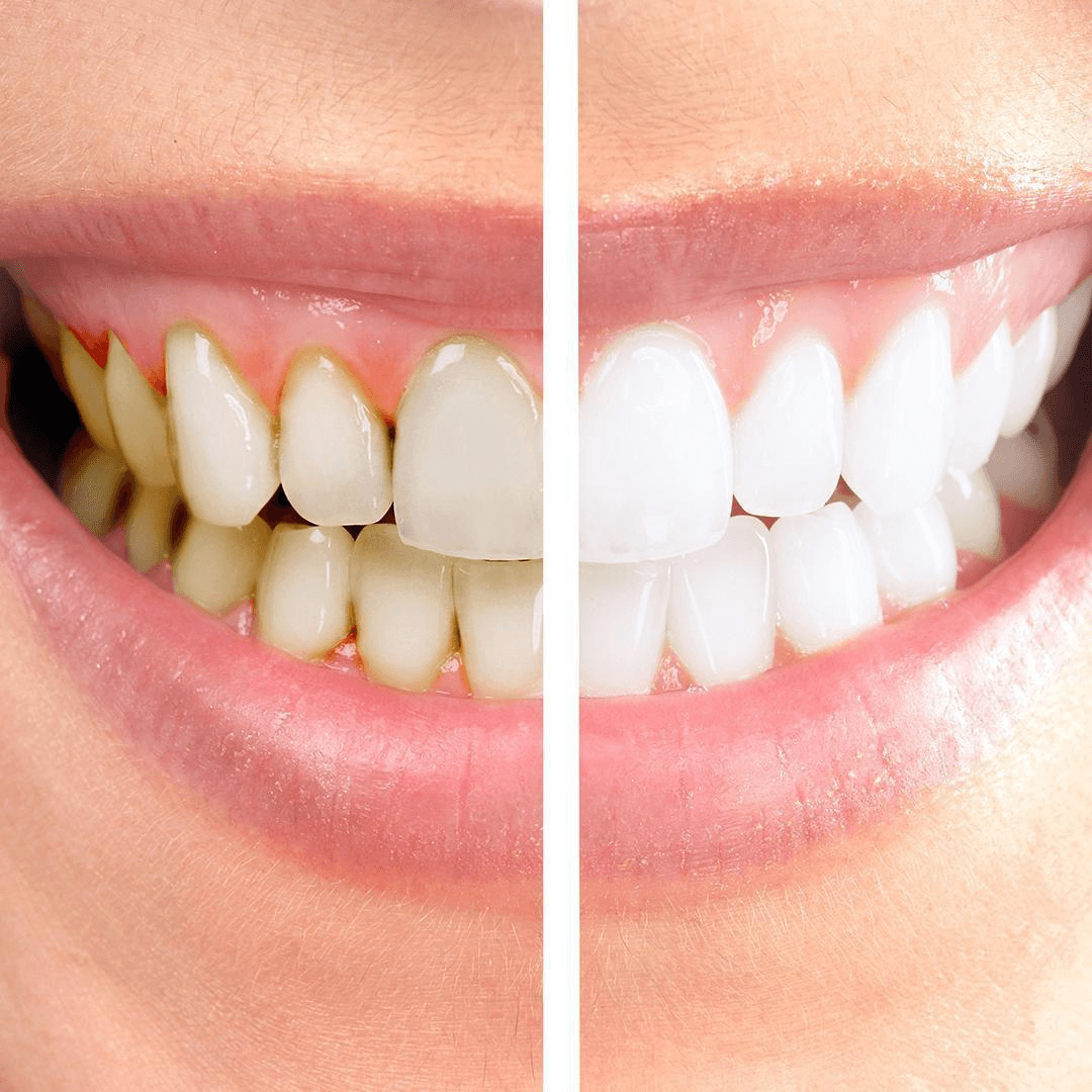 תוצאה קלינית 8 - Doctor Ox