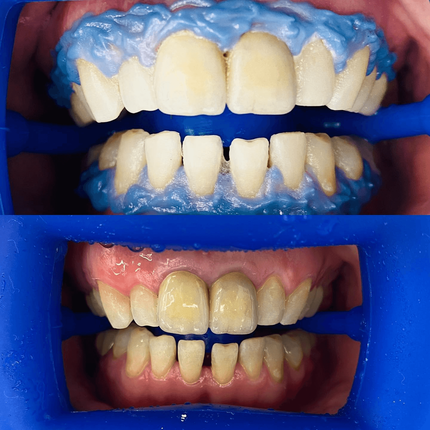 תוצאה קלינית 10 - Doctor Ox