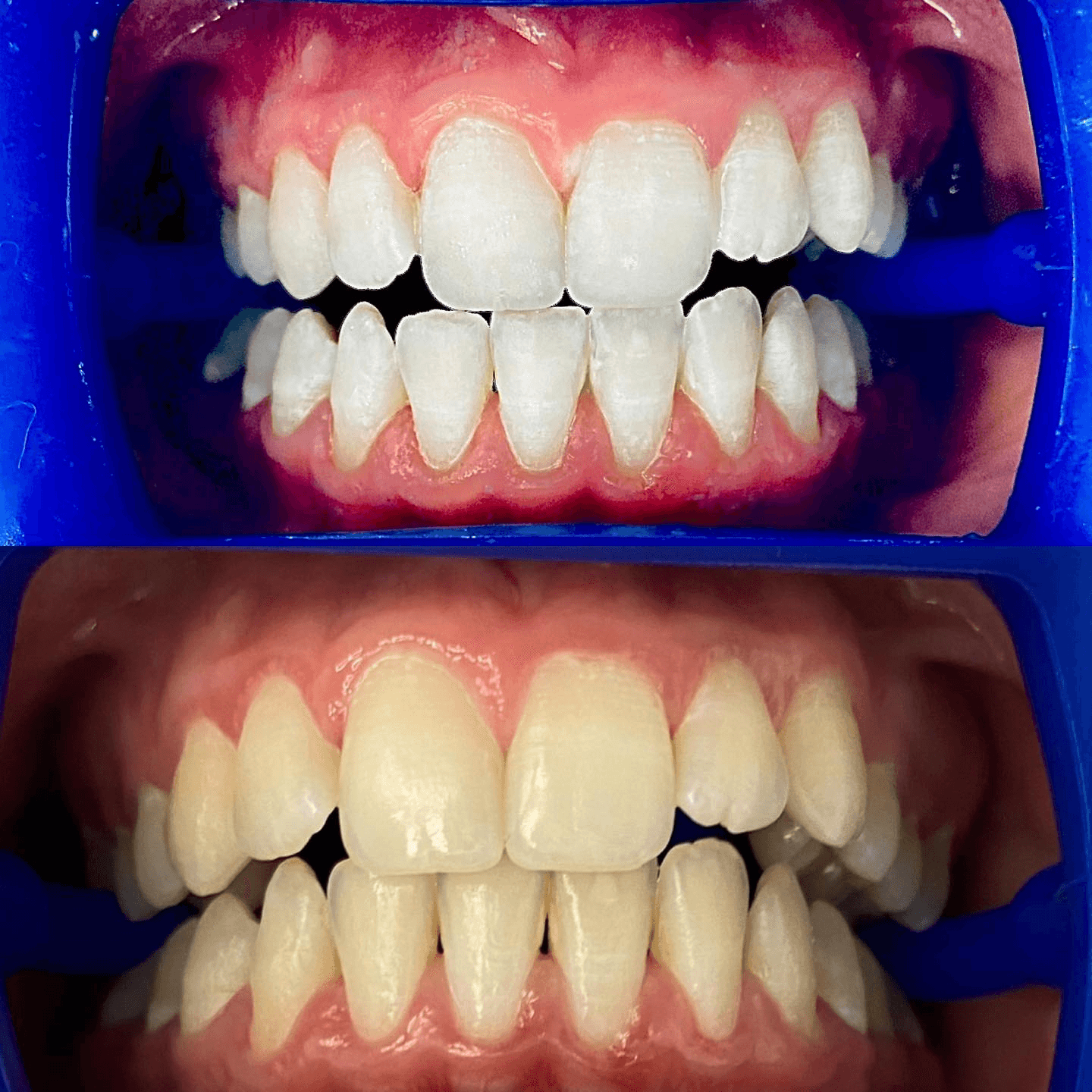 תוצאה קלינית 11 - Doctor Ox