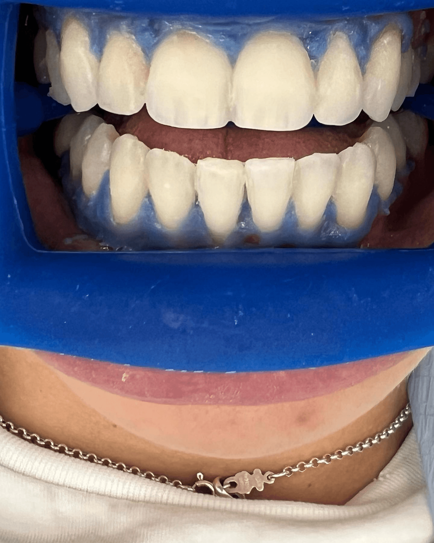 תוצאה קלינית 12 - Doctor Ox