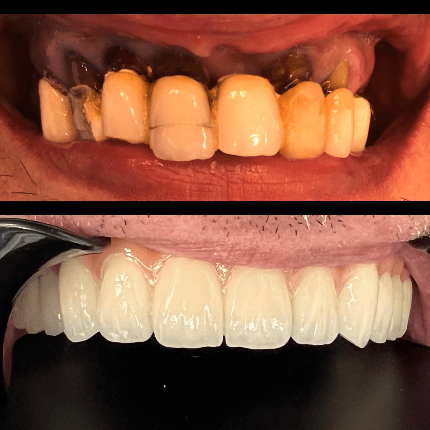 תוצאה קלינית 14 - Doctor Ox