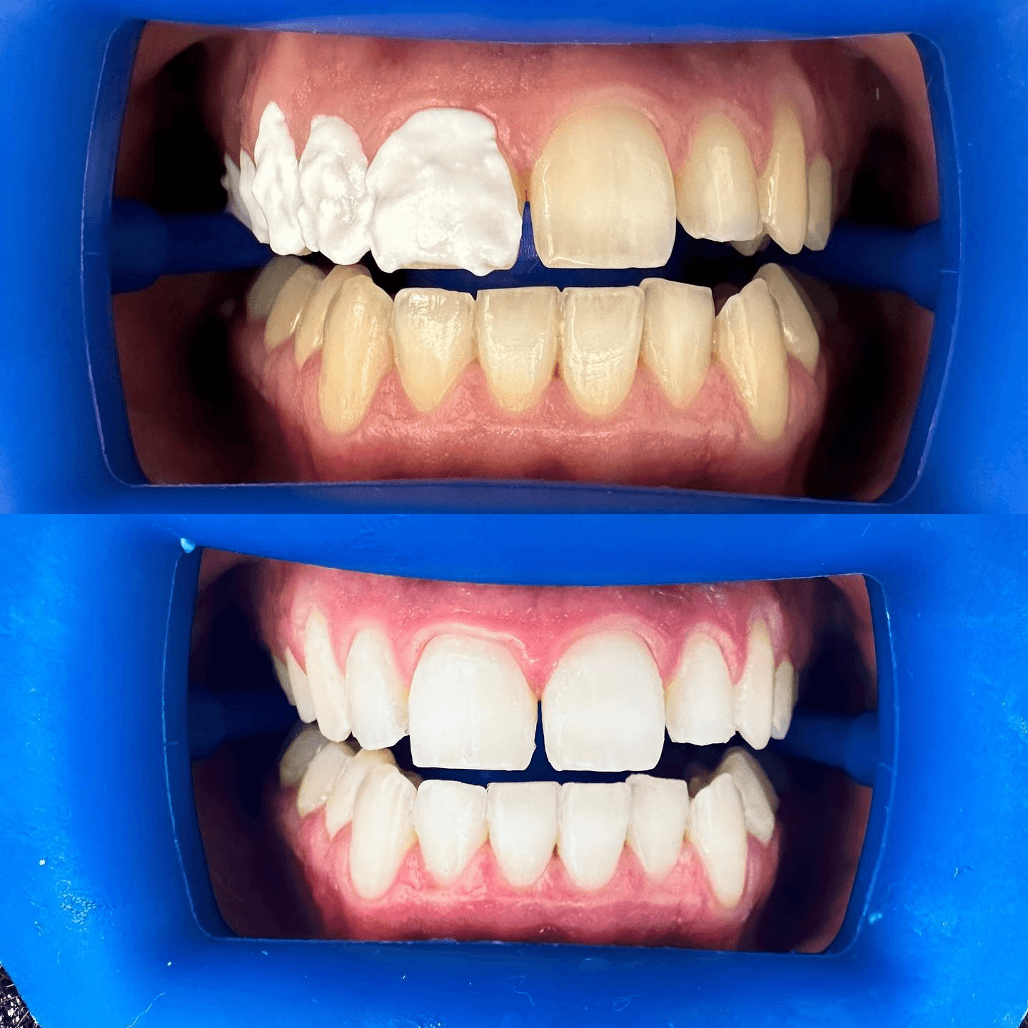 תוצאה קלינית 15 - Doctor Ox